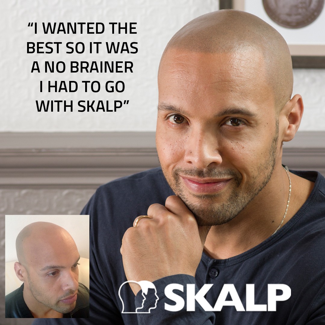 skalp