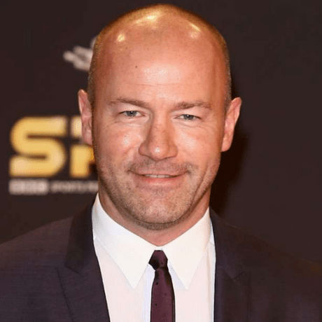 Alan Shearer hair loss