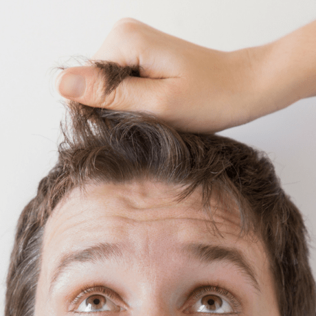 hair loss facts