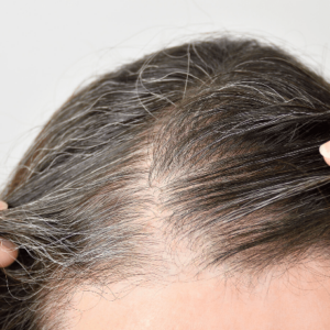 mens hair turns grey