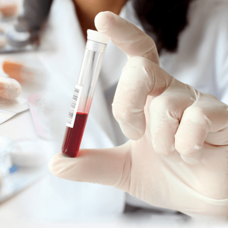 blood sample