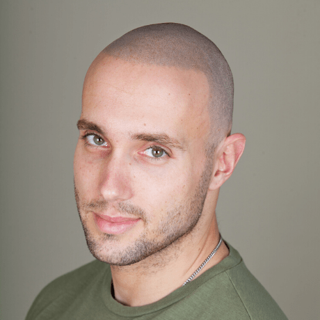 hair tattoo results on attractive bald man