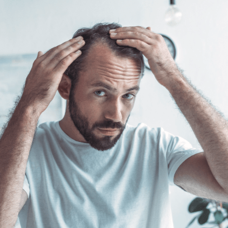 hair loss solutions for receding hairline