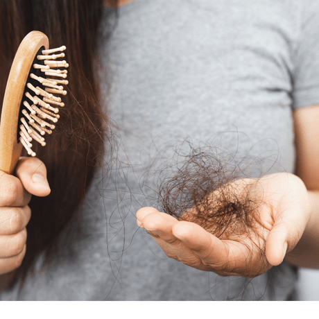 Woman with hair loss